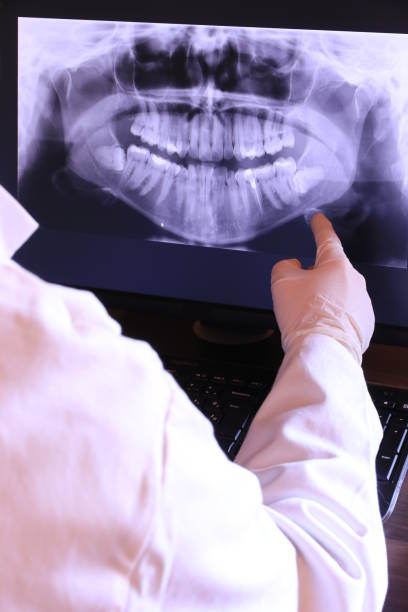 Best Emergency Treatment for Dental Infections or Abscesses in Alturas, CA
